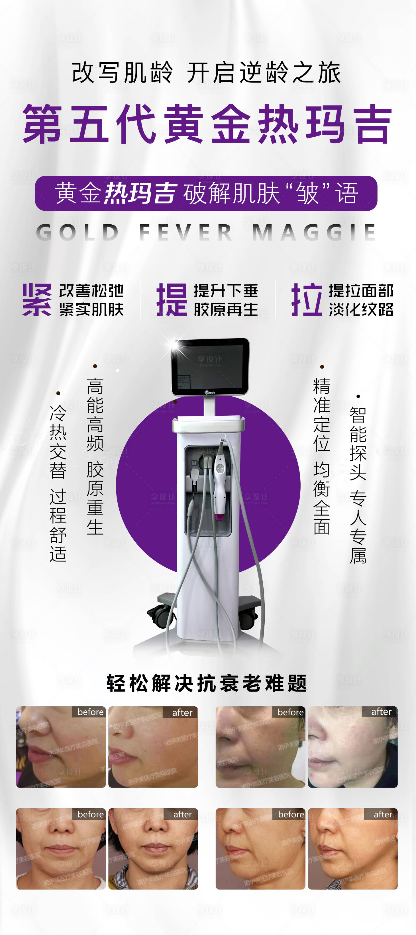 源文件下载【享设计】搜索编号：41690004024369859【热玛吉展架】
