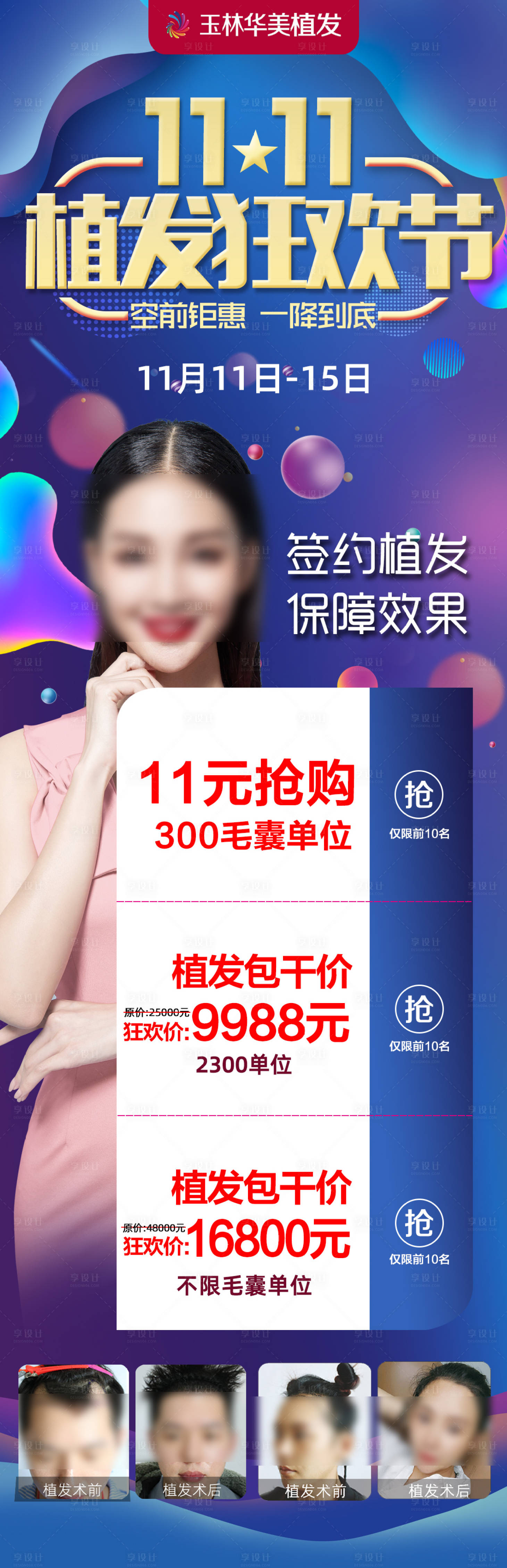 源文件下载【享设计】搜索编号：17240004287938387【医美植发活动长图海报】