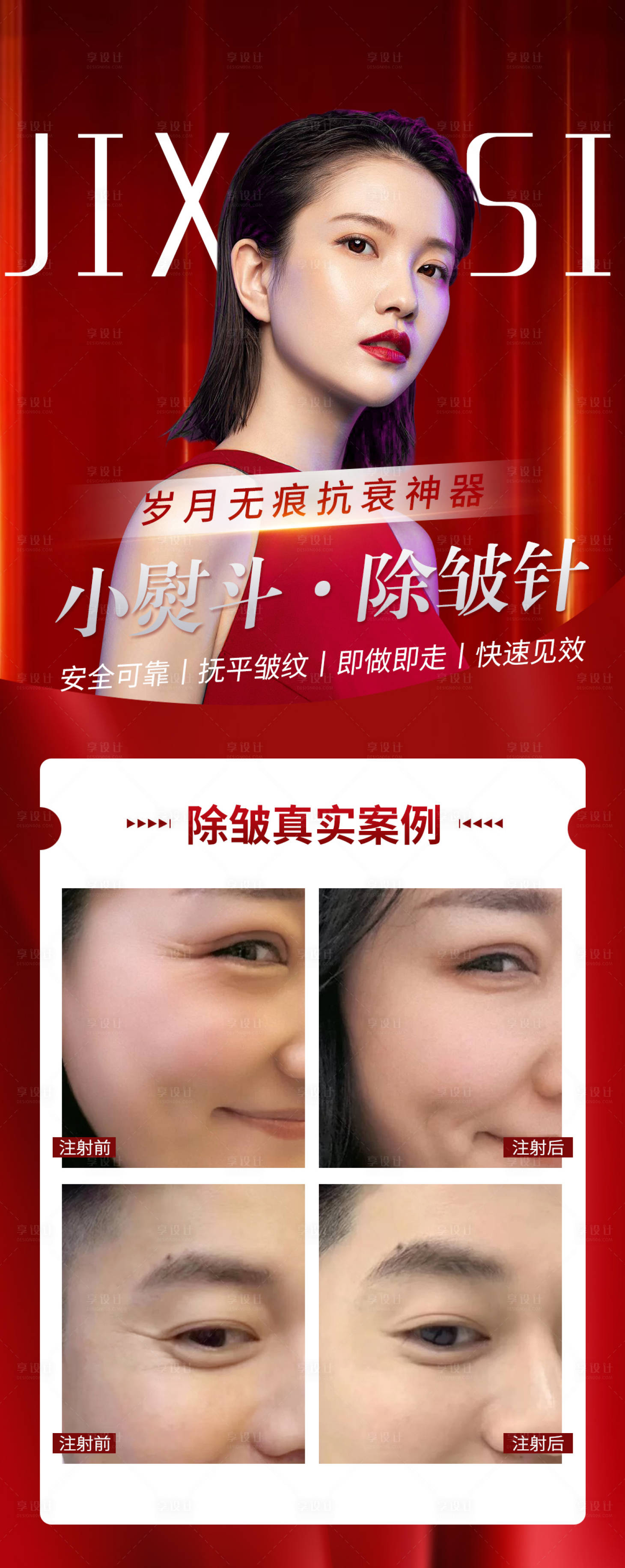 源文件下载【享设计】搜索编号：10480004334735735【医美整形美容除皱对比案例海报瘦脸】