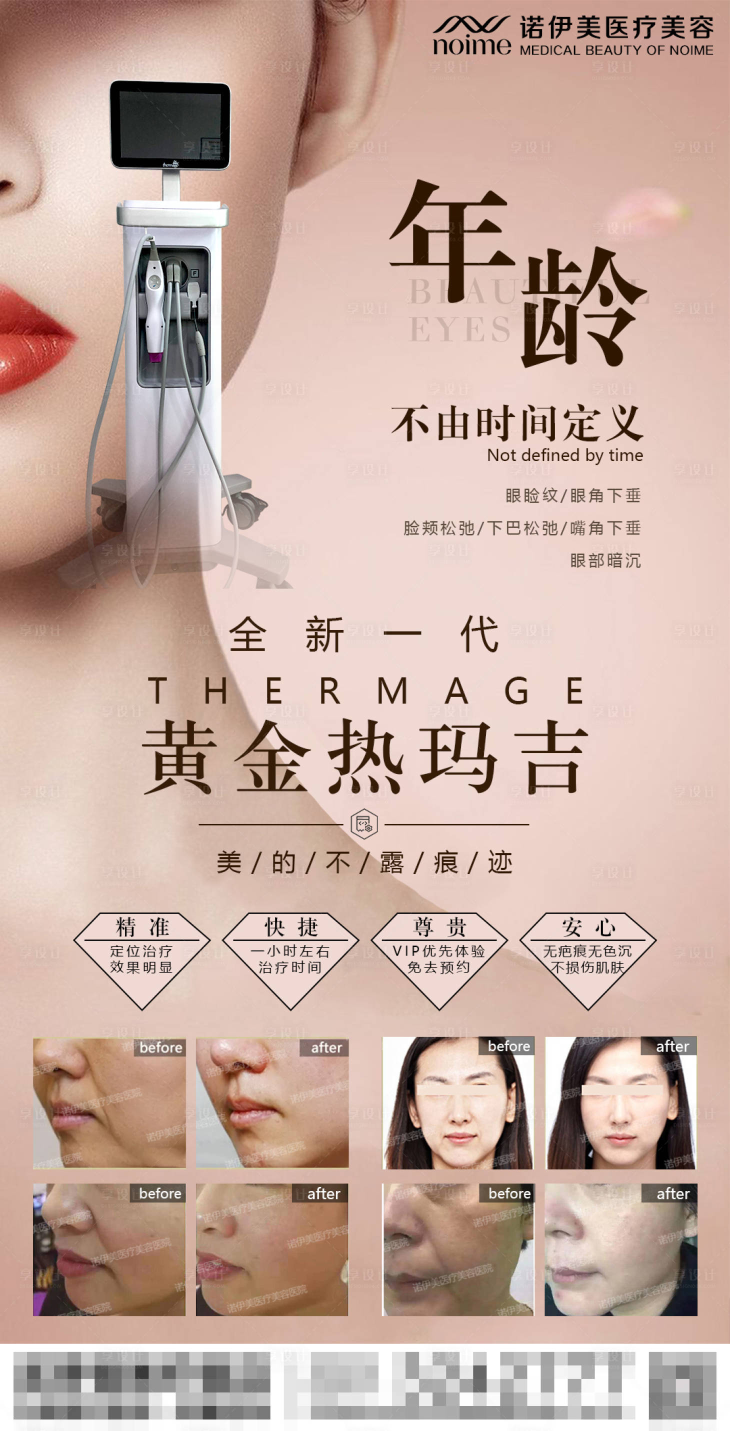 源文件下載【享設(shè)計(jì)】搜索編號：51330004374305543【醫(yī)美熱瑪吉宣傳海報】