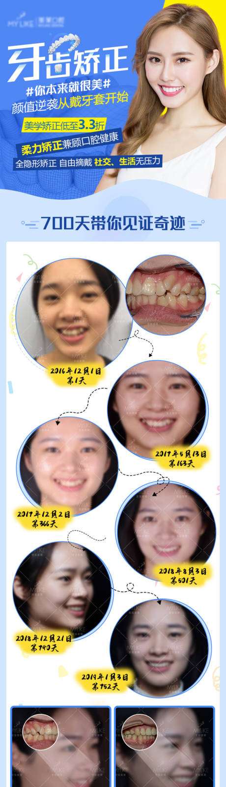源文件下载【享设计】搜索编号：80240004234148001【口腔矫正详情页】