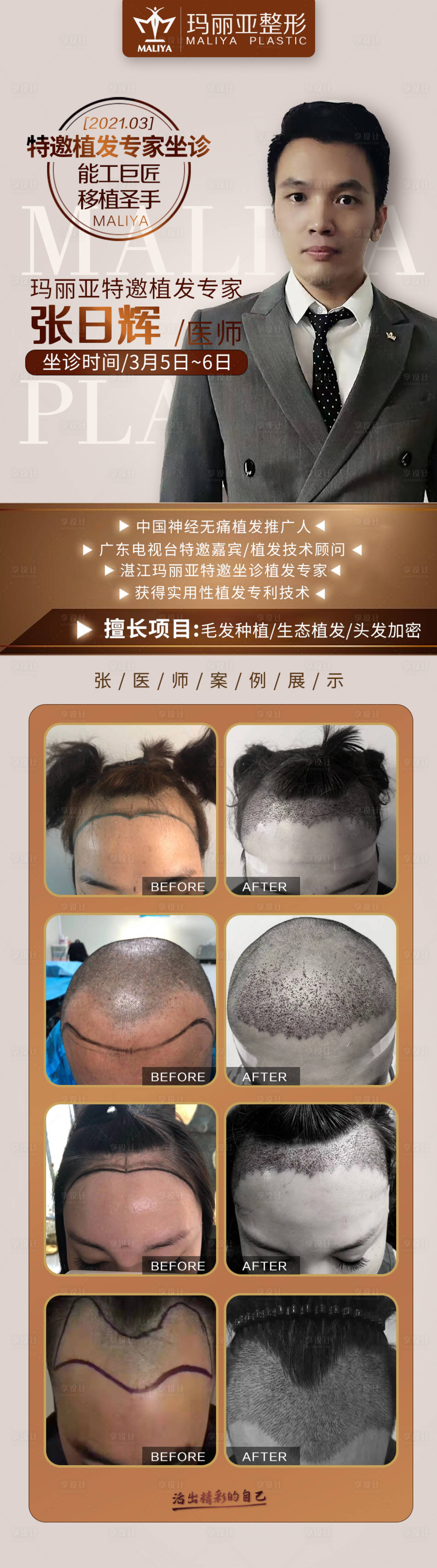 源文件下载【享设计】搜索编号：10190004390557059【医美整形植发专家介绍案例】