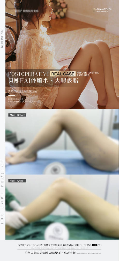 源文件下载【医美案例对比海报】编号：37590004205351198
