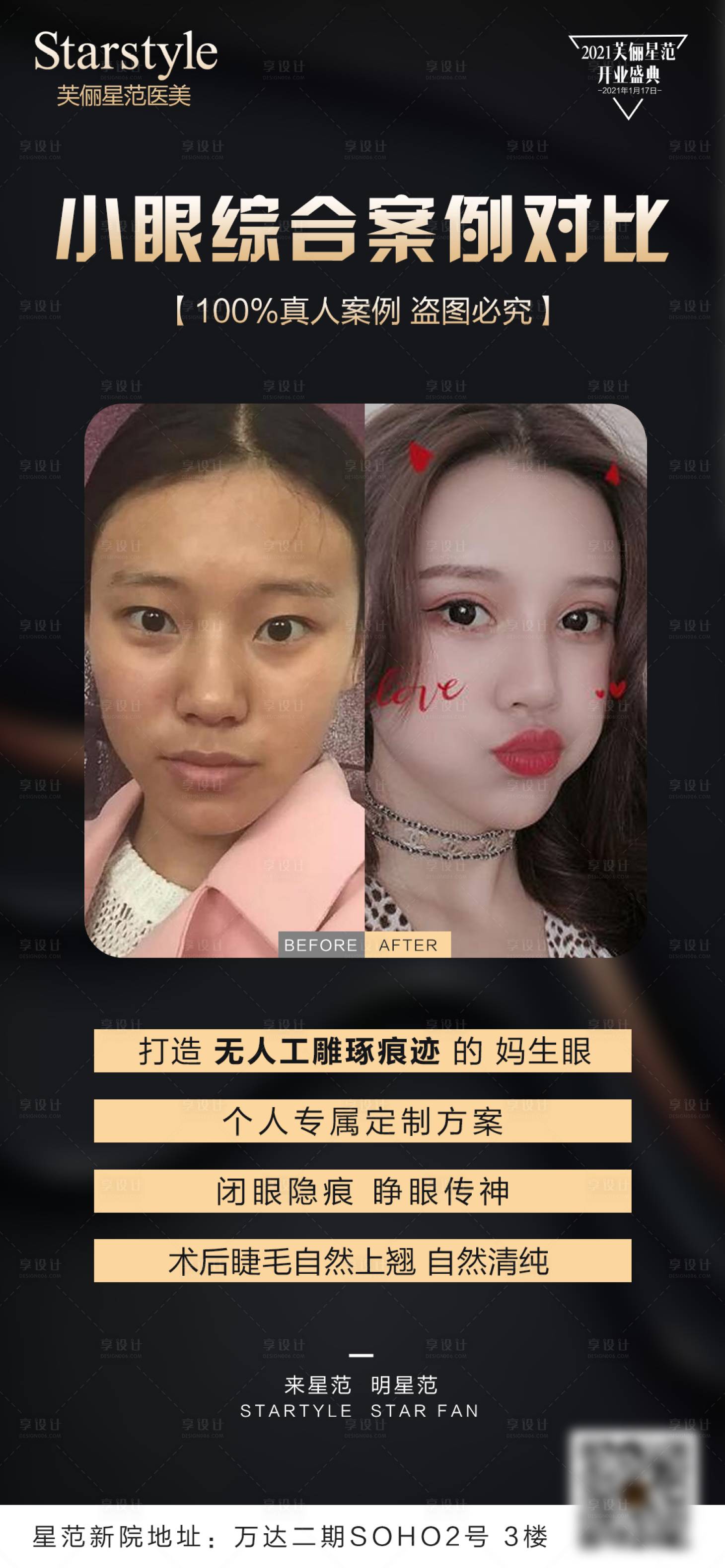 源文件下载【享设计】搜索编号：59870004451225747【医美眼综合案例对比海报】