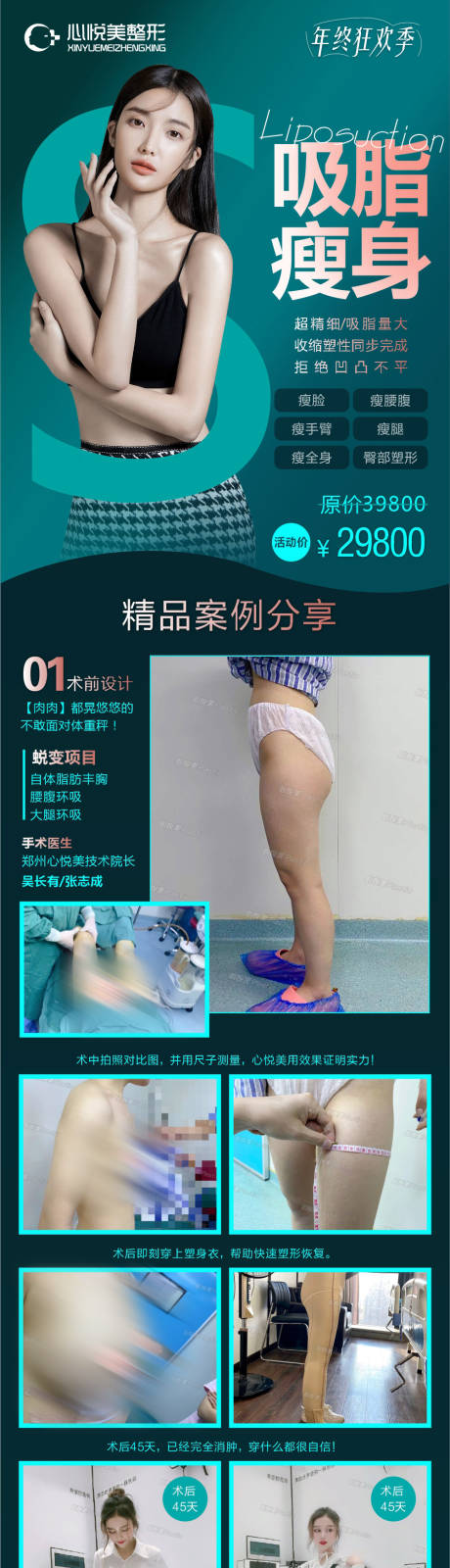 源文件下載【吸脂瘦身長圖海報】編號：32200003407167564