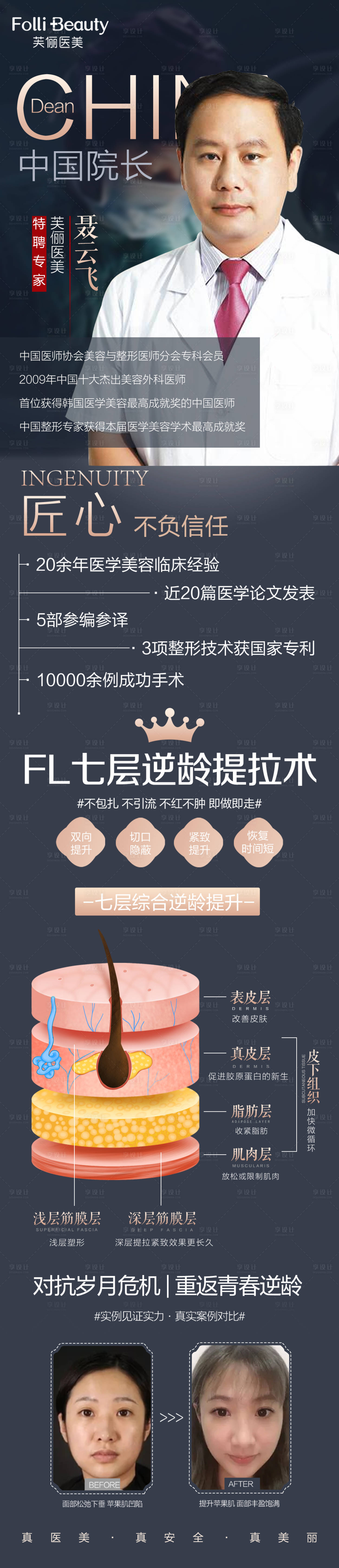 源文件下載【享設(shè)計(jì)】搜索編號(hào)：17150004305396044【醫(yī)美整形專家抗衰長(zhǎng)圖】