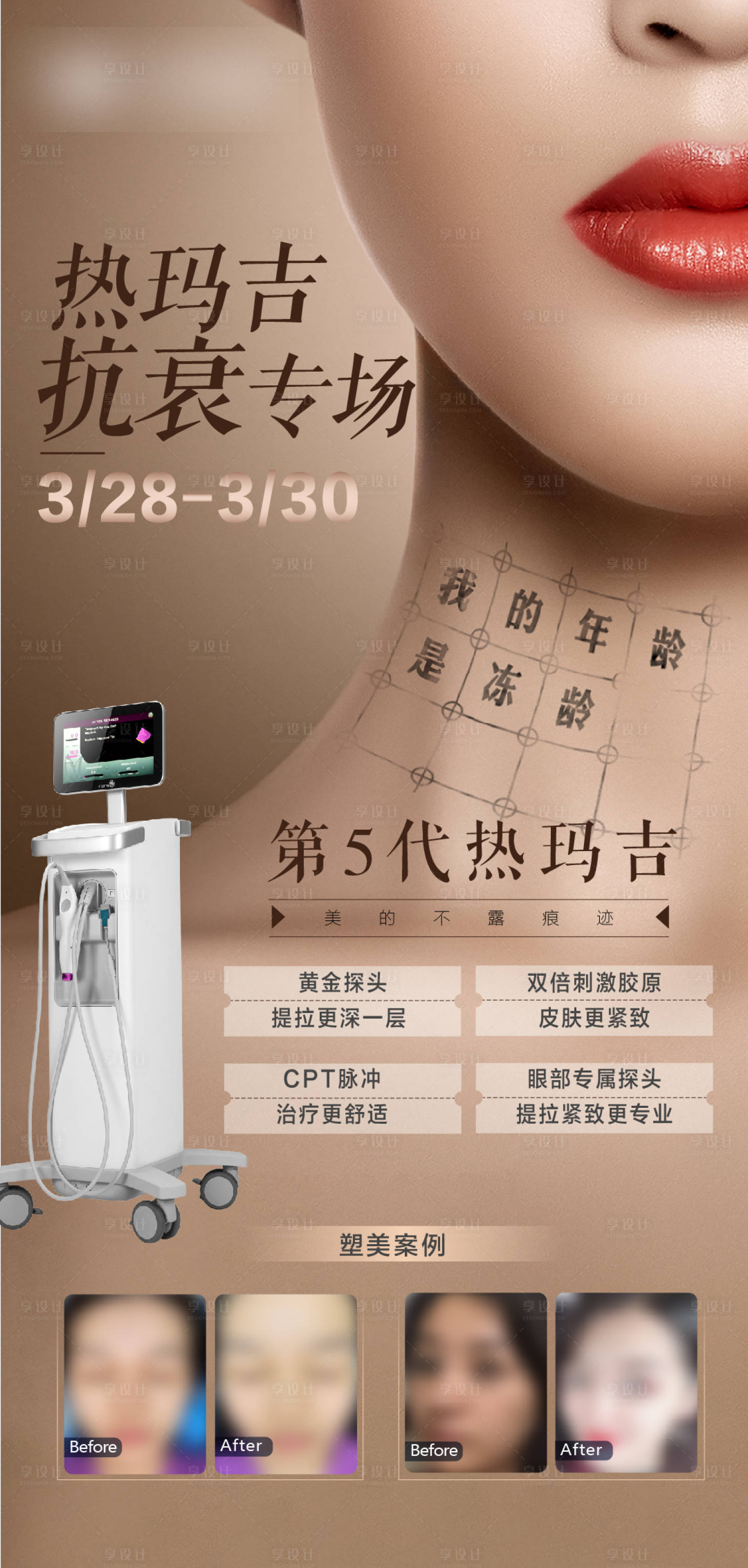 源文件下载【热玛吉专场】编号：37510004210228999