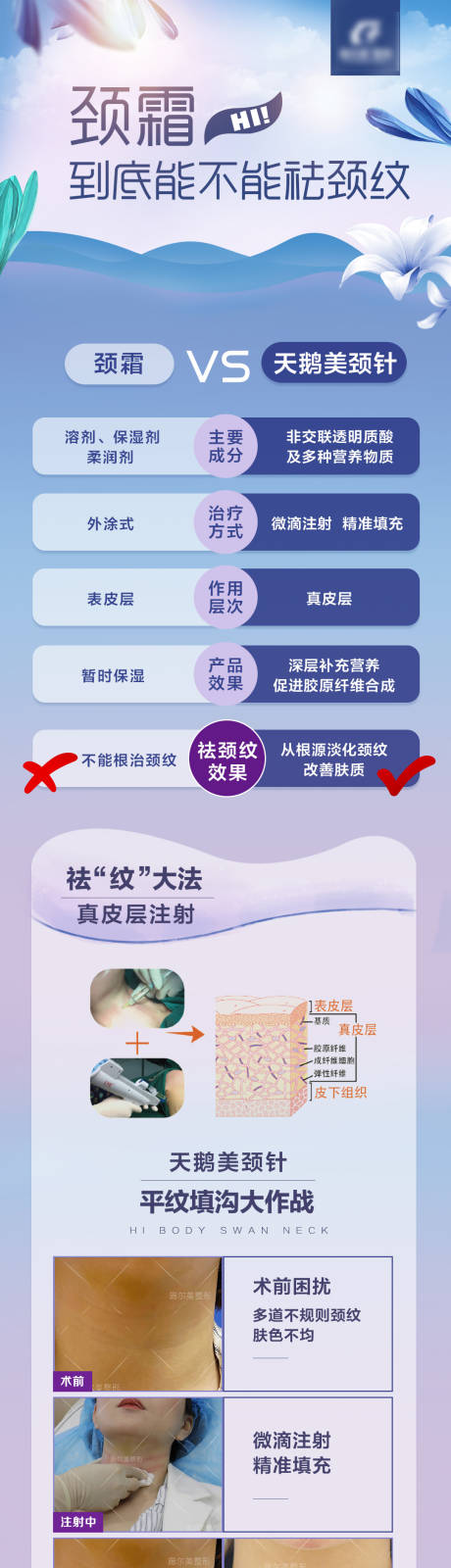 源文件下載【醫美頸霜與美頸針對比海報】編號：54530004569278152