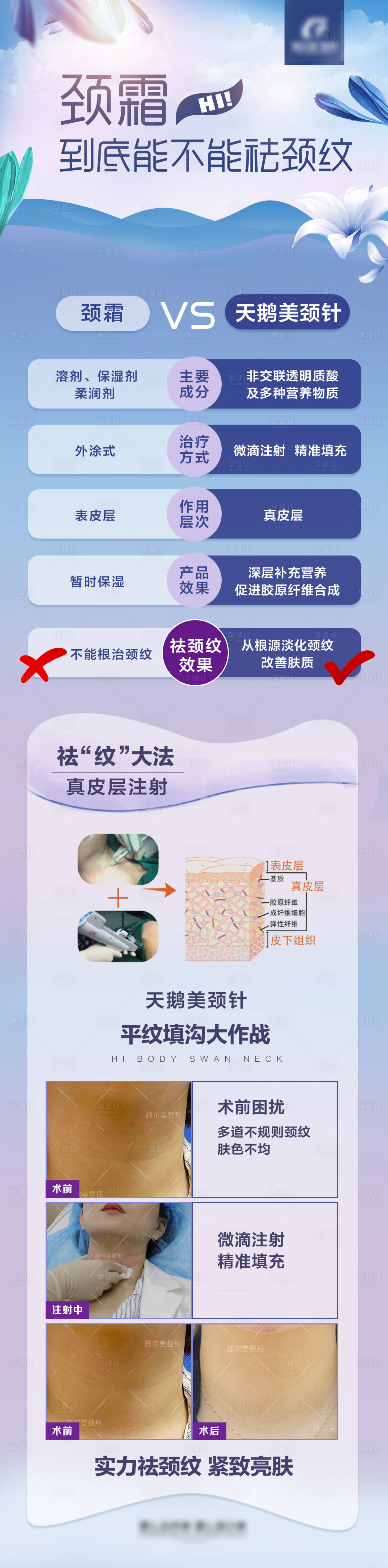 源文件下載【醫美頸霜與美頸針對比海報】編號：54530004569278152