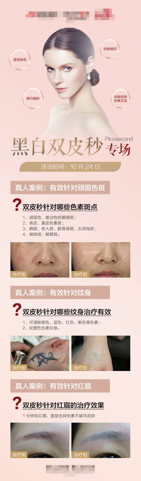源文件下載【享設計】搜索編號：17360004820936608【醫美雙皮秒祛斑長圖】