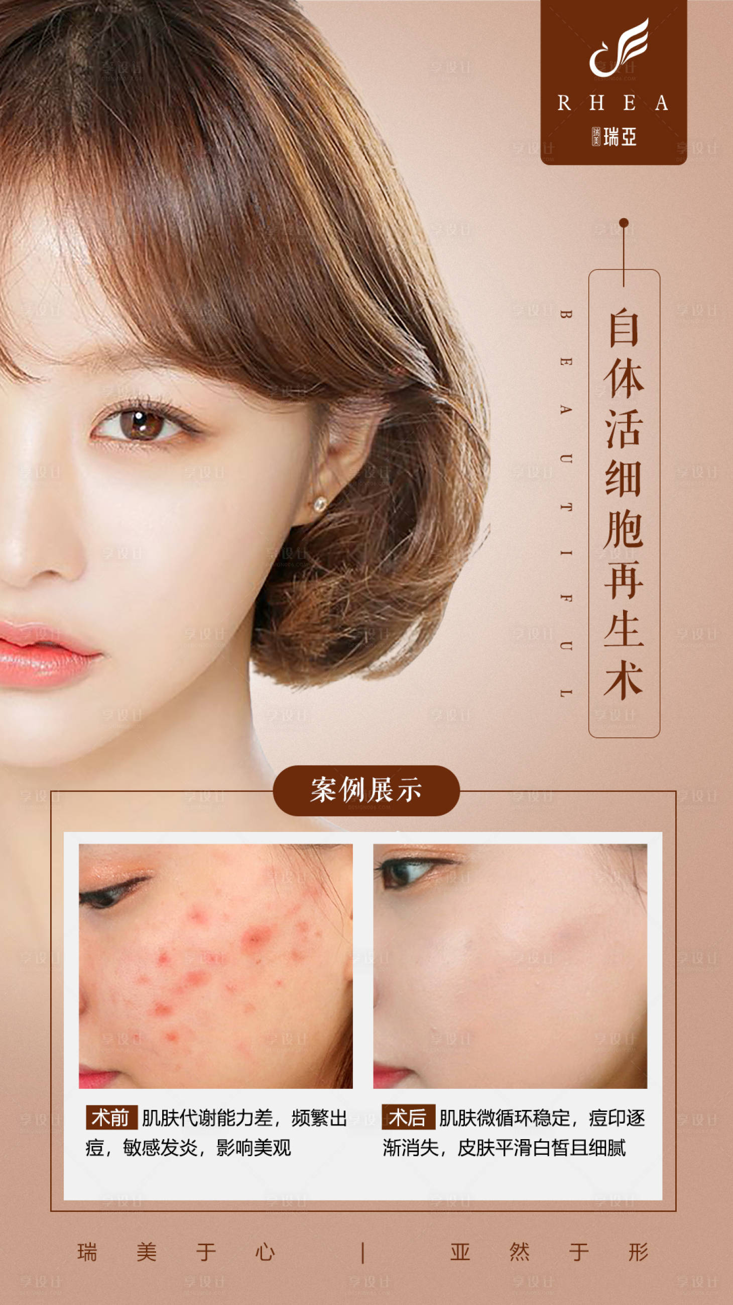 源文件下載【享設計】搜索編號：50960004707572300【皮膚案例對比】