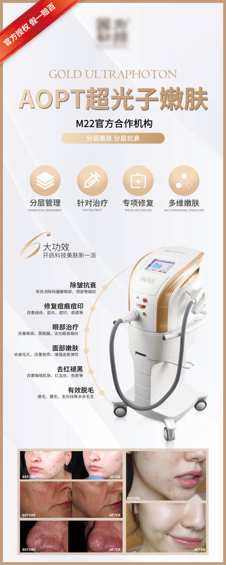 源文件下载【享设计】搜索编号：73600004710199534【医美光子嫩肤易拉宝】