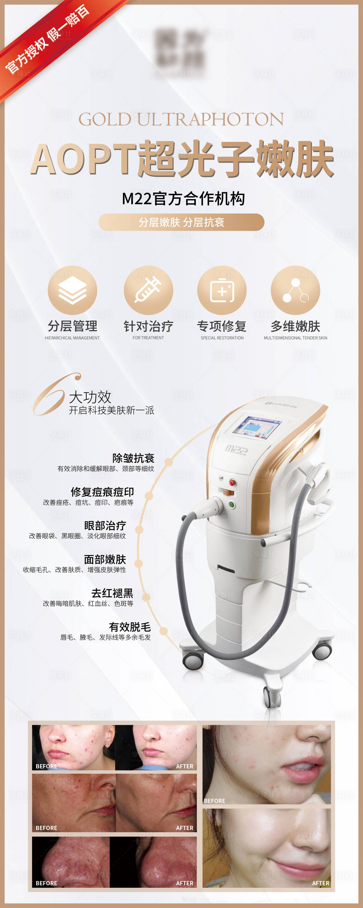 源文件下载【享设计】搜索编号：73600004710199534【医美光子嫩肤易拉宝】