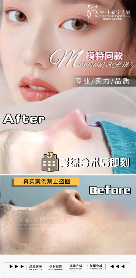 源文件下载【鼻综合案例】编号：30000004626226098