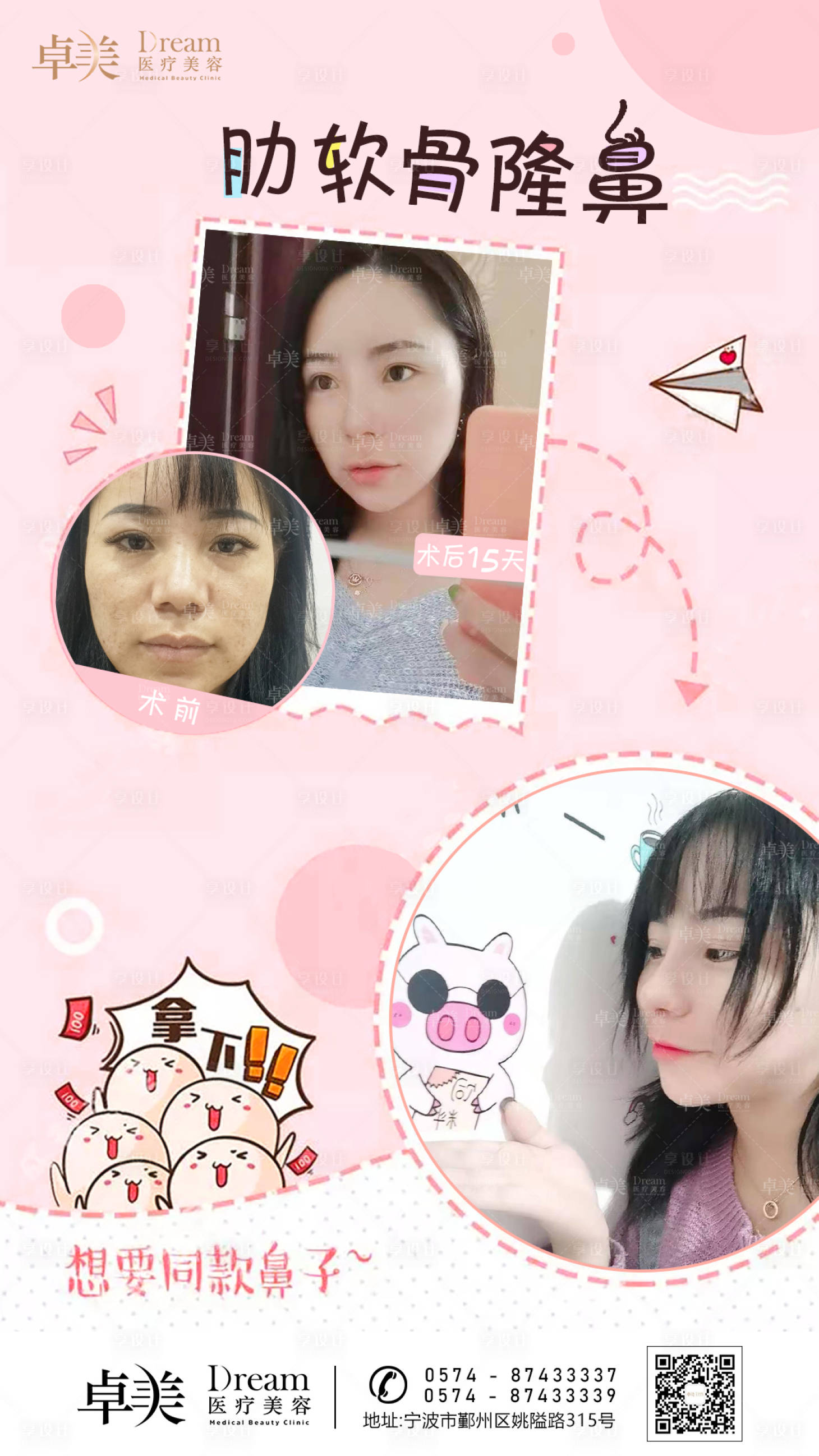 源文件下载【享设计】搜索编号：26770004808191457【医美整形案例对比图】