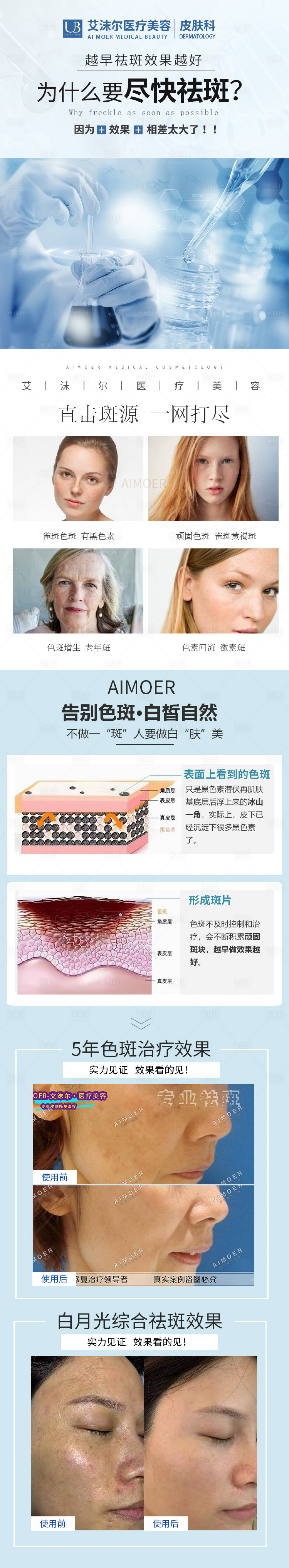 源文件下载【医美祛斑长图】编号：61890004592792056