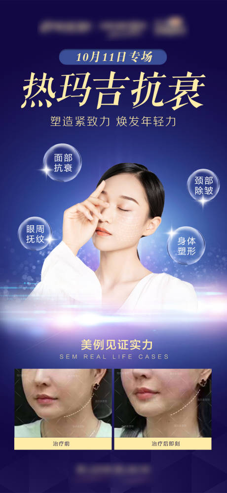 源文件下載【醫美熱瑪吉抗衰海報】編號：14960004623607642