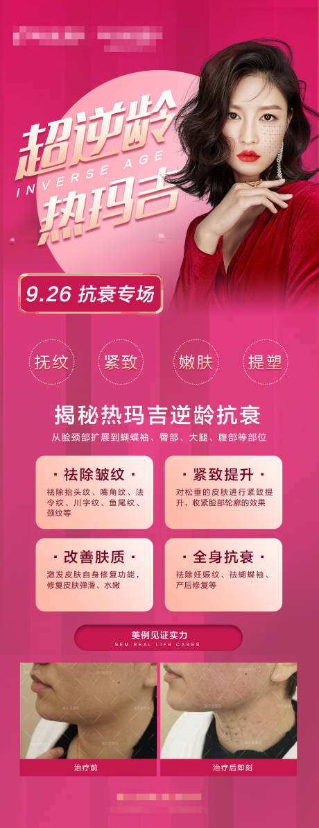 源文件下载【医美热玛吉粉色活动长图】编号：97660004819227177