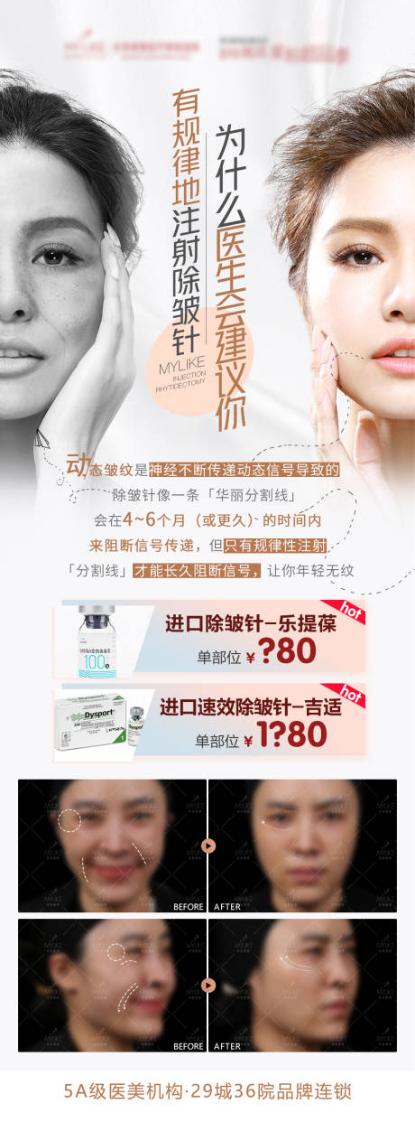 源文件下載【享設計】搜索編號：45050004582832691【也沒肉毒素除皺針朋友圈長圖】