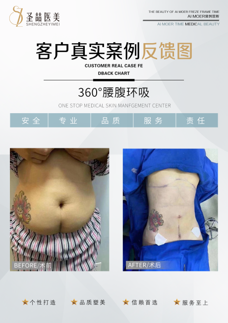 源文件下载【享设计】搜索编号：37050004919421625【医美整形案例海报】
