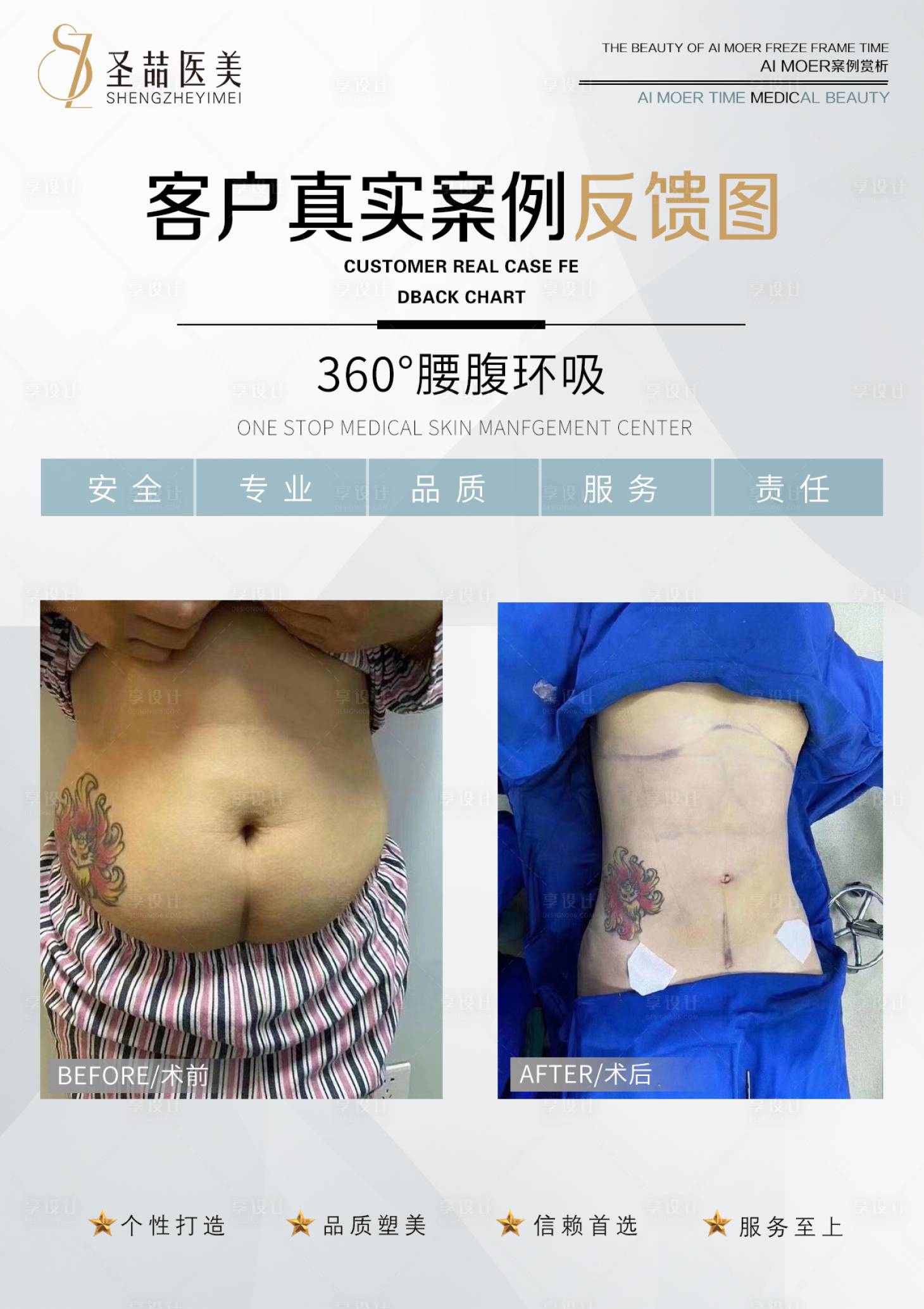源文件下载【享设计】搜索编号：37050004919421625【医美整形案例海报】