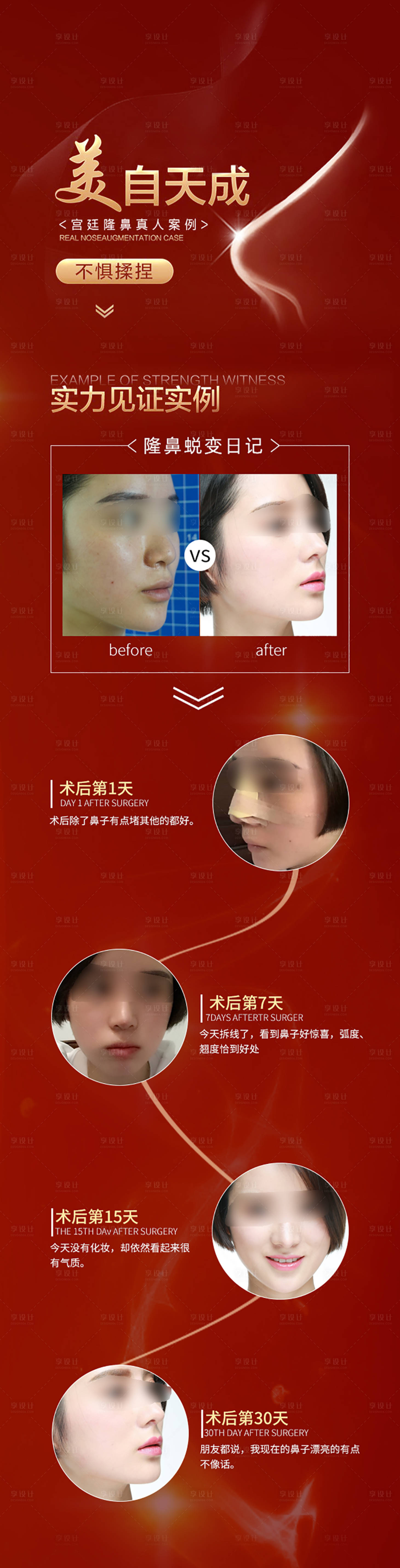 源文件下载【享设计】搜索编号：85030004819589712【隆鼻案例长图】