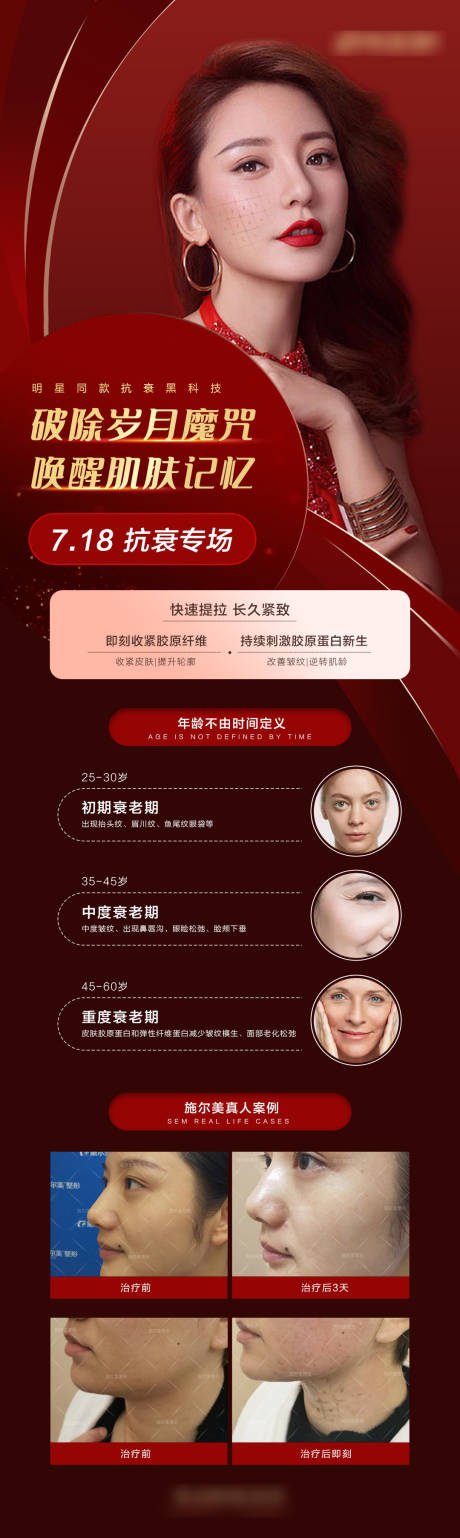 源文件下载【医美热玛吉红色长图】编号：23050004605446279