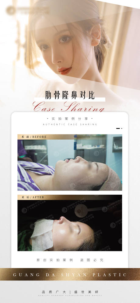 源文件下载【医美隆鼻案例对比图】编号：77850004899162032
