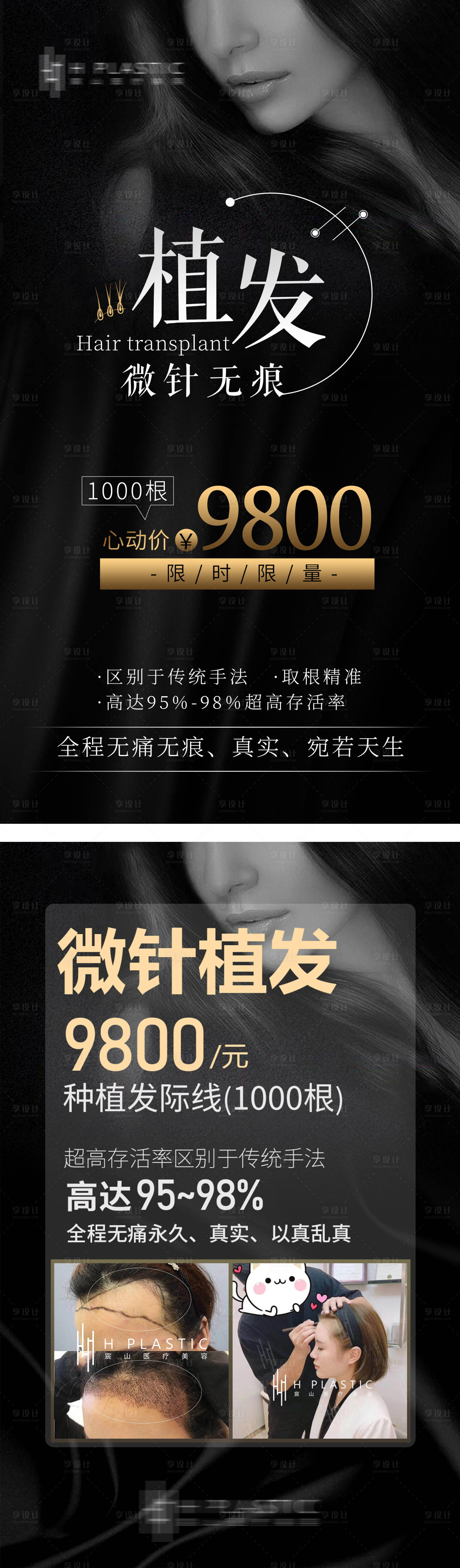 源文件下載【享設計】搜索編號：72390004964022348【植發海報】