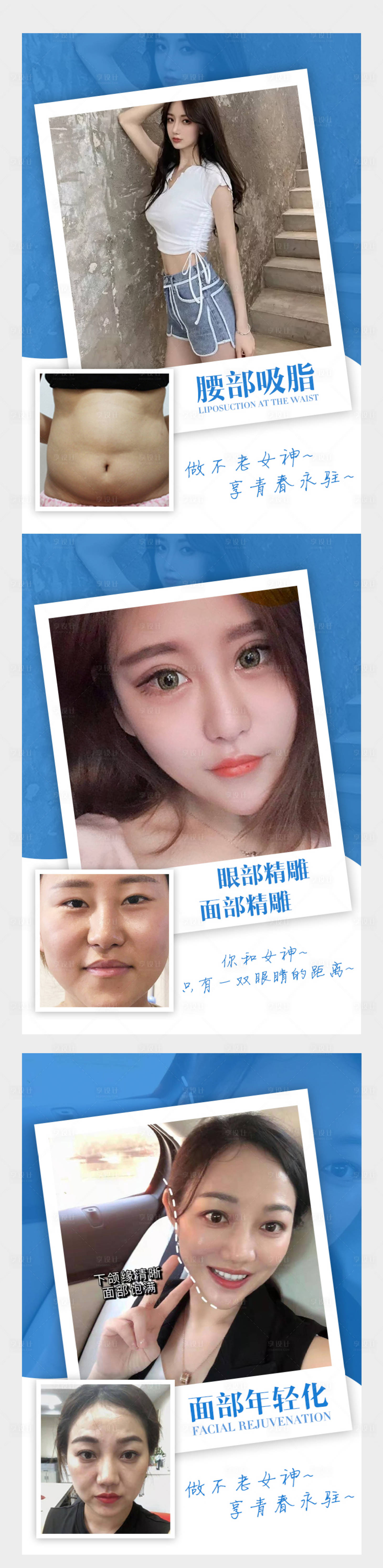 源文件下載【享設計】搜索編號：13500004957263827【醫美整形案例對比海報】