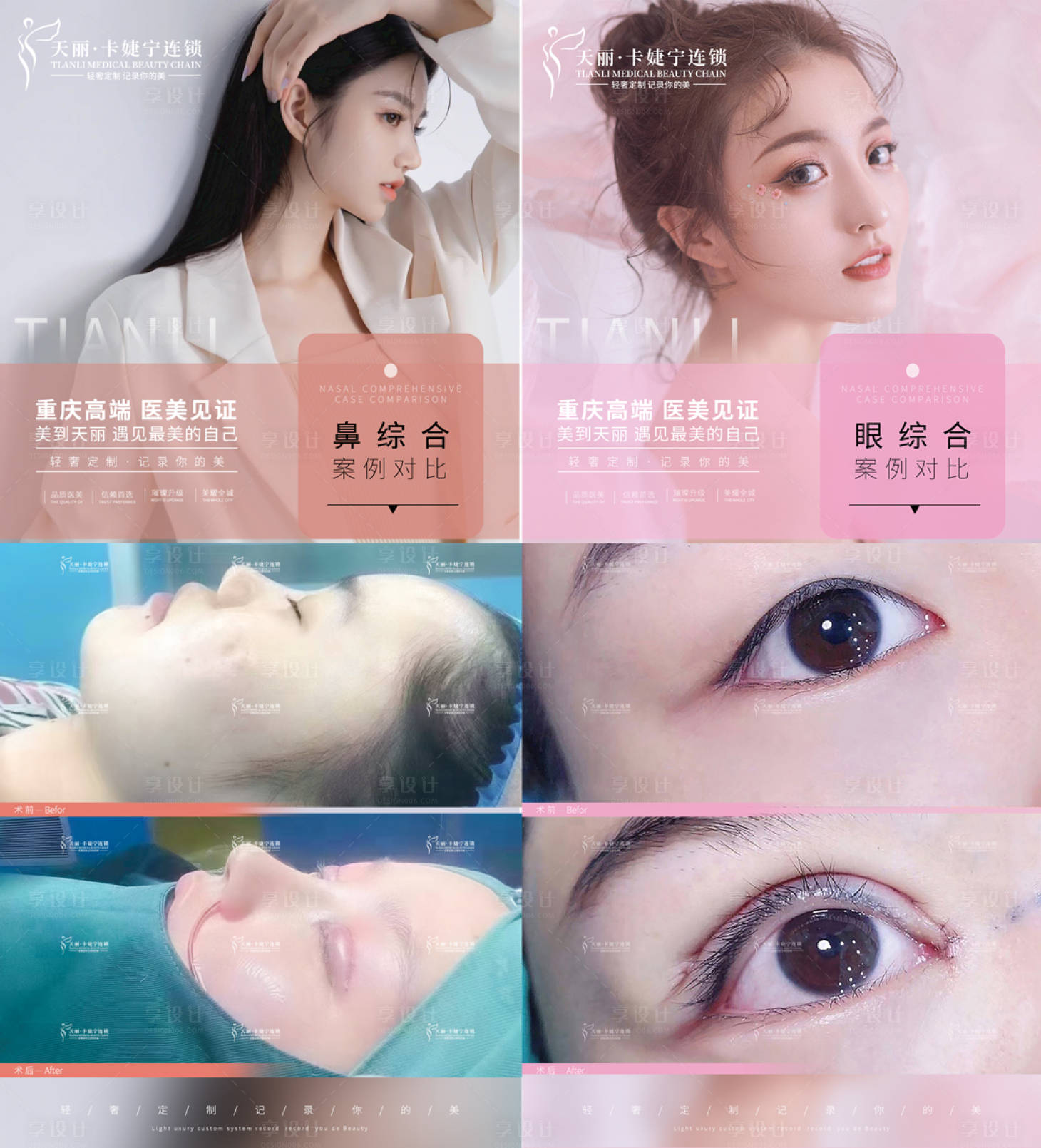 源文件下載【享設計】搜索編號：95160004987417114【醫美朋友圈案例海報】