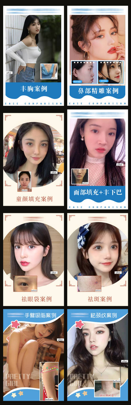 源文件下载【医美整形案例】编号：26390005121549138