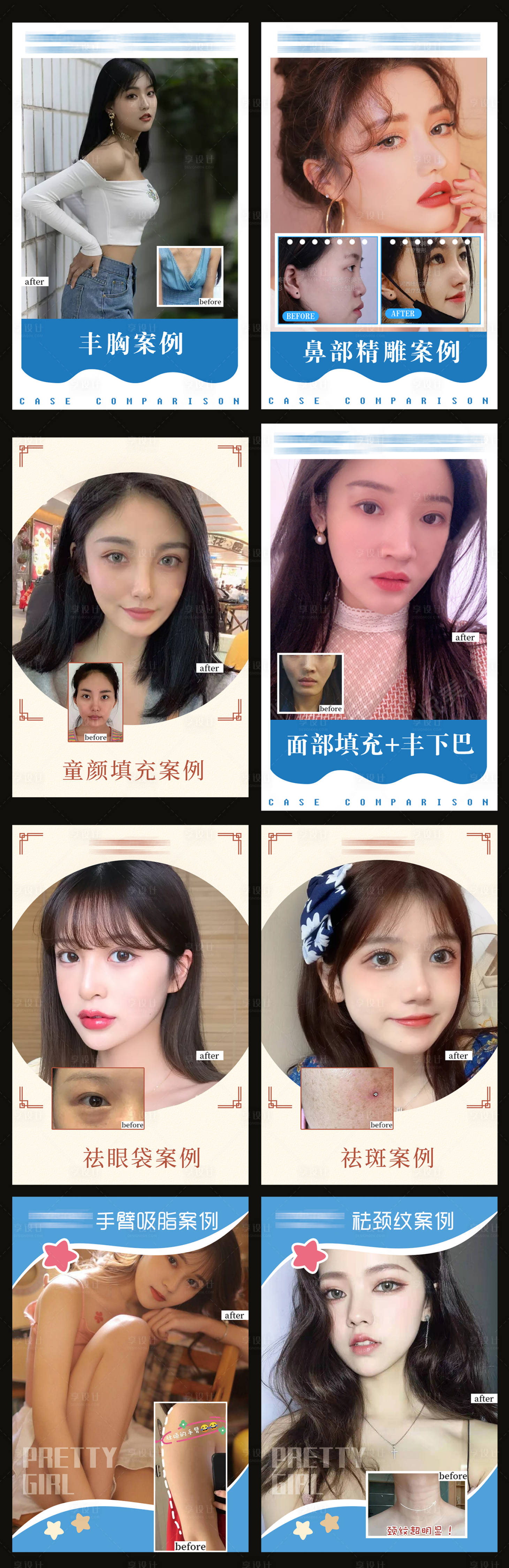 源文件下載【享設計】搜索編號：26390005121549138【醫美整形案例】
