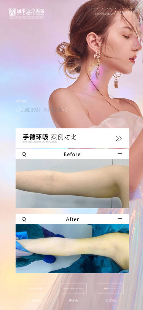 源文件下载【医美案例朋友圈宣传海报】编号：20210630155504375