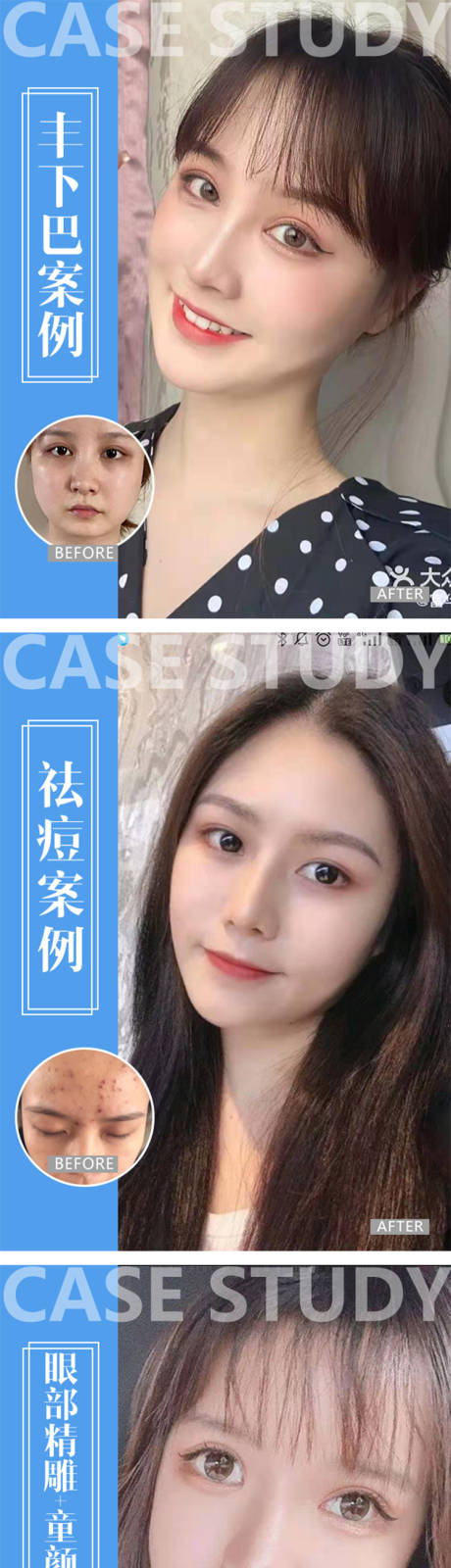 源文件下载【医美整形案例】编号：32820005023473783
