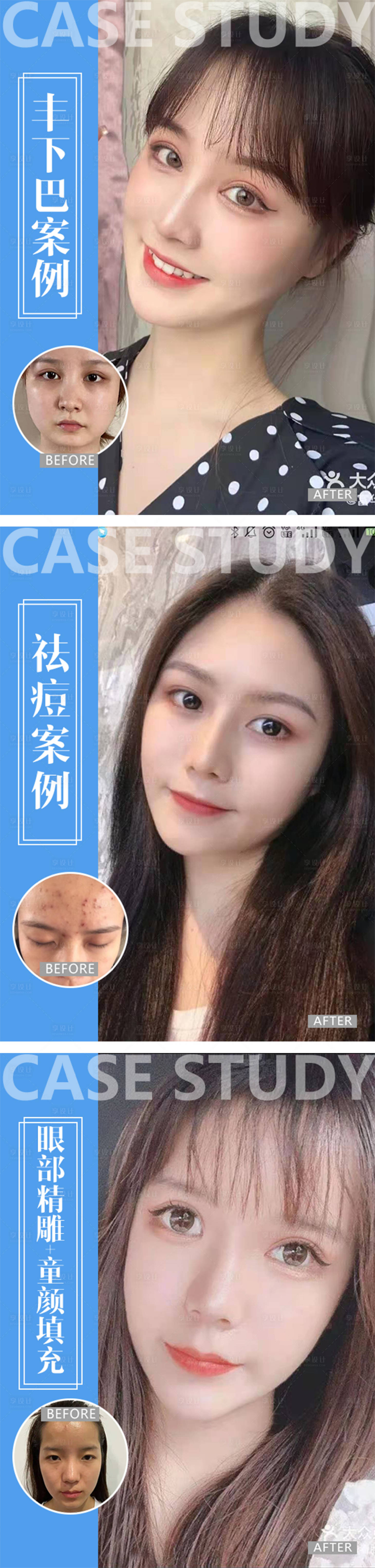 源文件下載【享設計】搜索編號：32820005023473783【醫美整形案例】