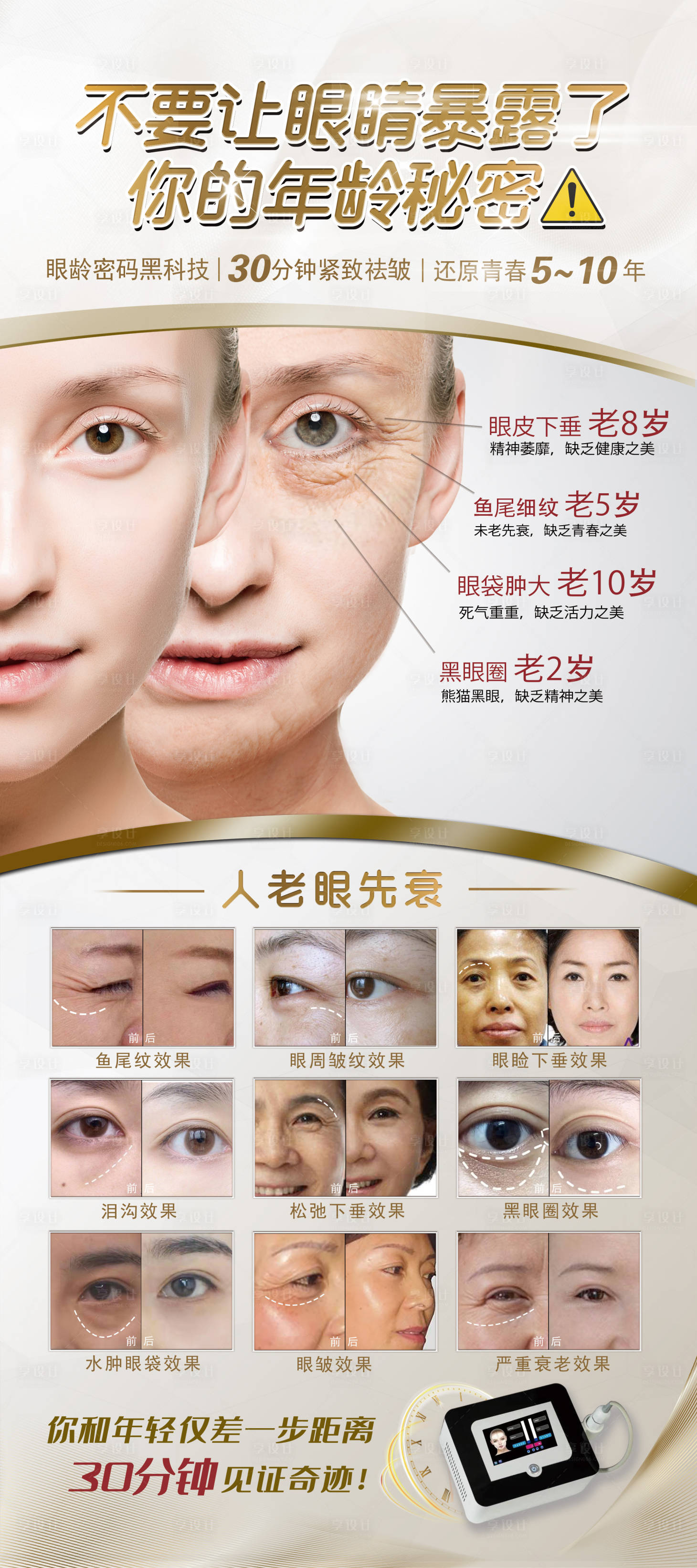 源文件下载【享设计】搜索编号：93340005281235737【医美眼部衰老展架】