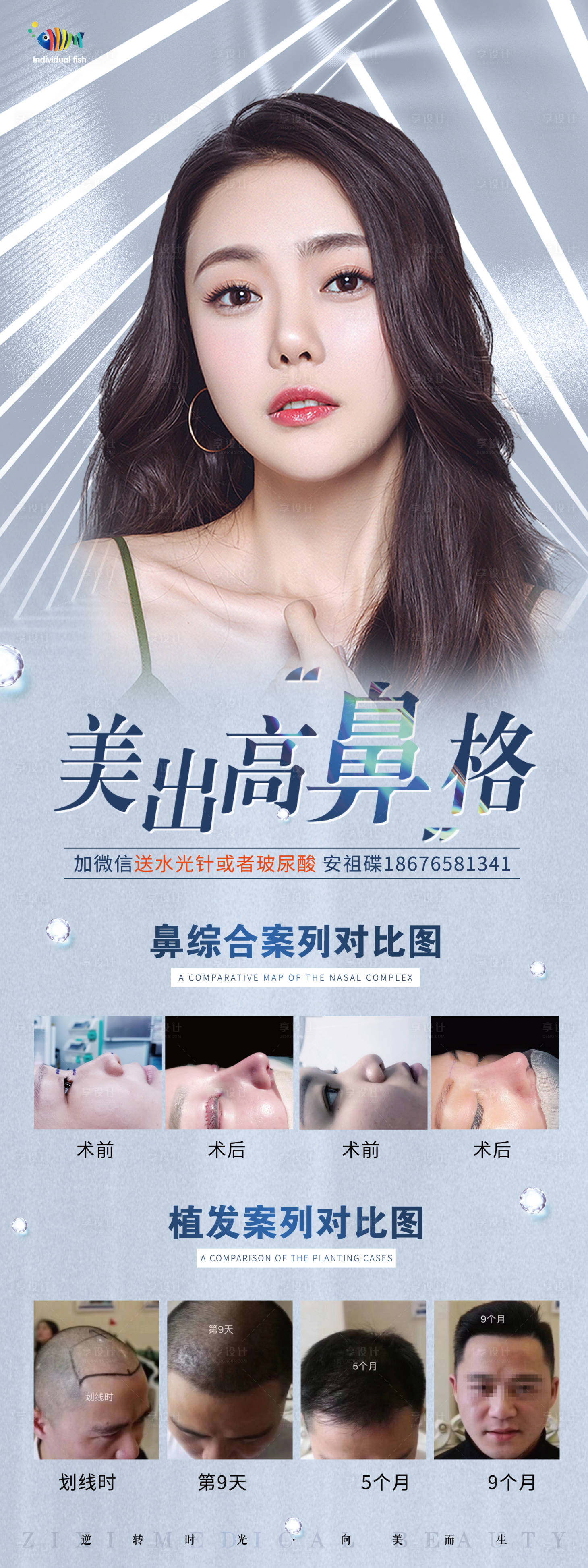 源文件下載【醫(yī)美展架易拉寶】編號：75300005014129720