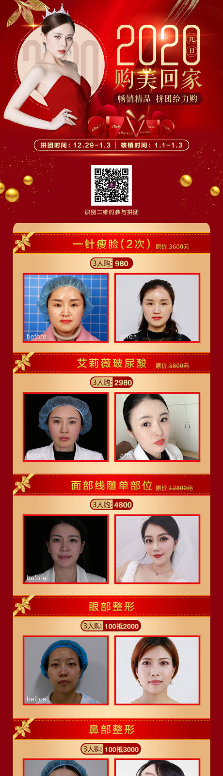 源文件下载【医美整形新年案例对比图】编号：79450005056256762