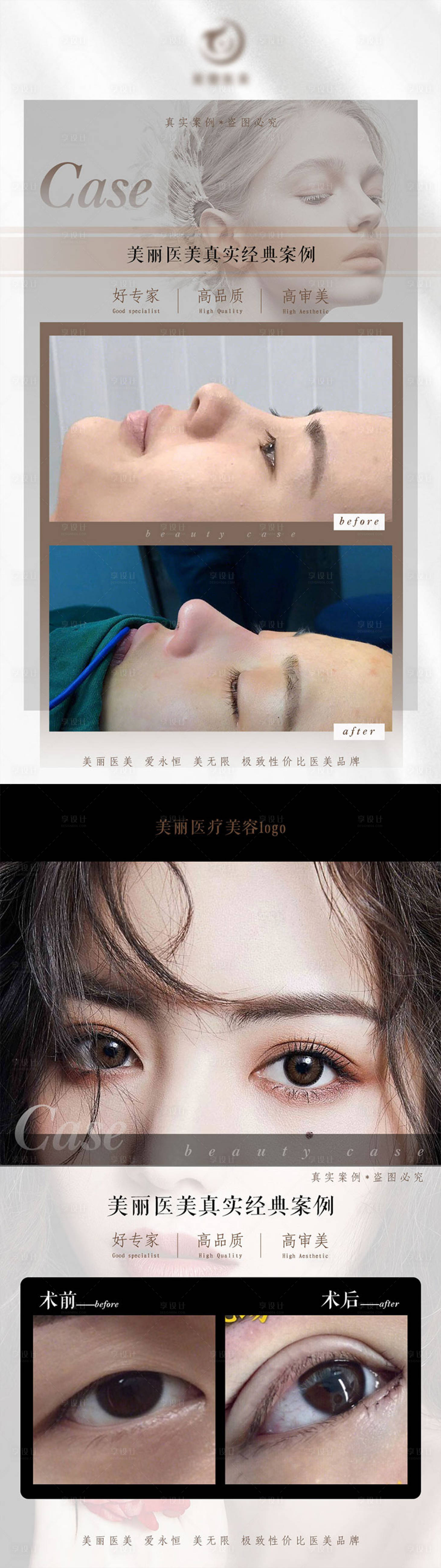 源文件下载【医美案例朋友圈宣传海报】编号：20290004973333530