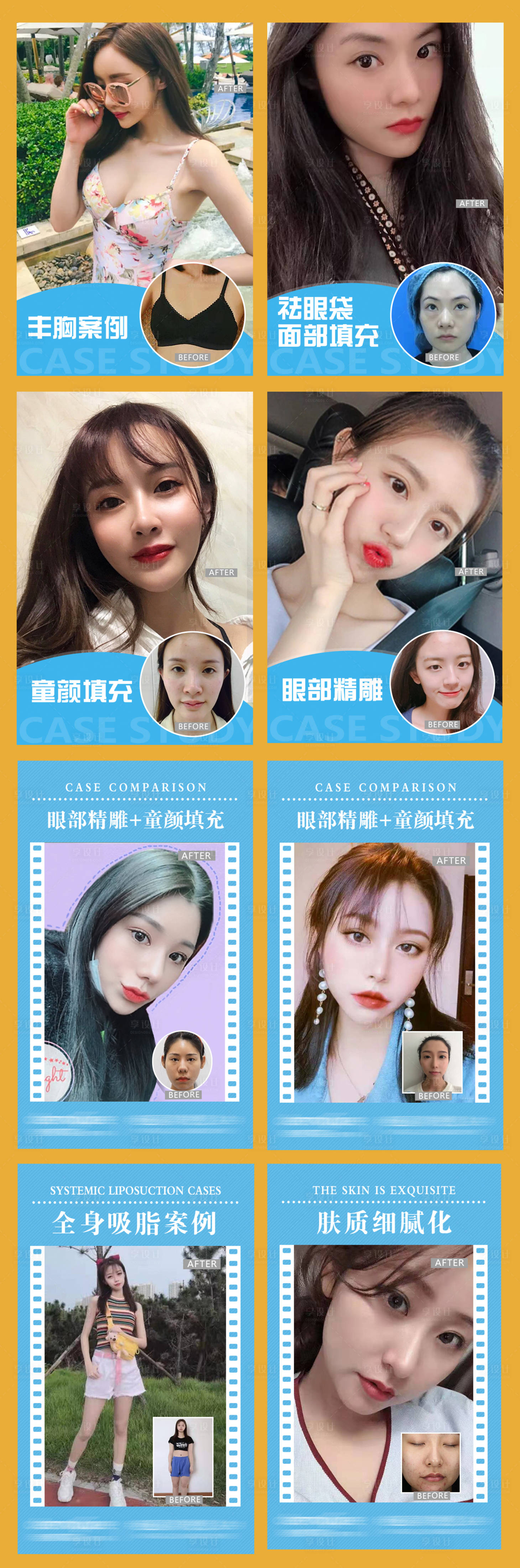 源文件下载【享设计】搜索编号：53640005062889876【医美整形案例对比系列海报】