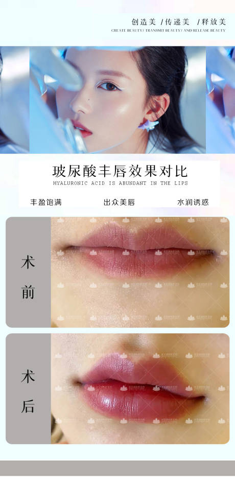源文件下载【医美玻尿酸丰唇对比海报】编号：19860005156635669