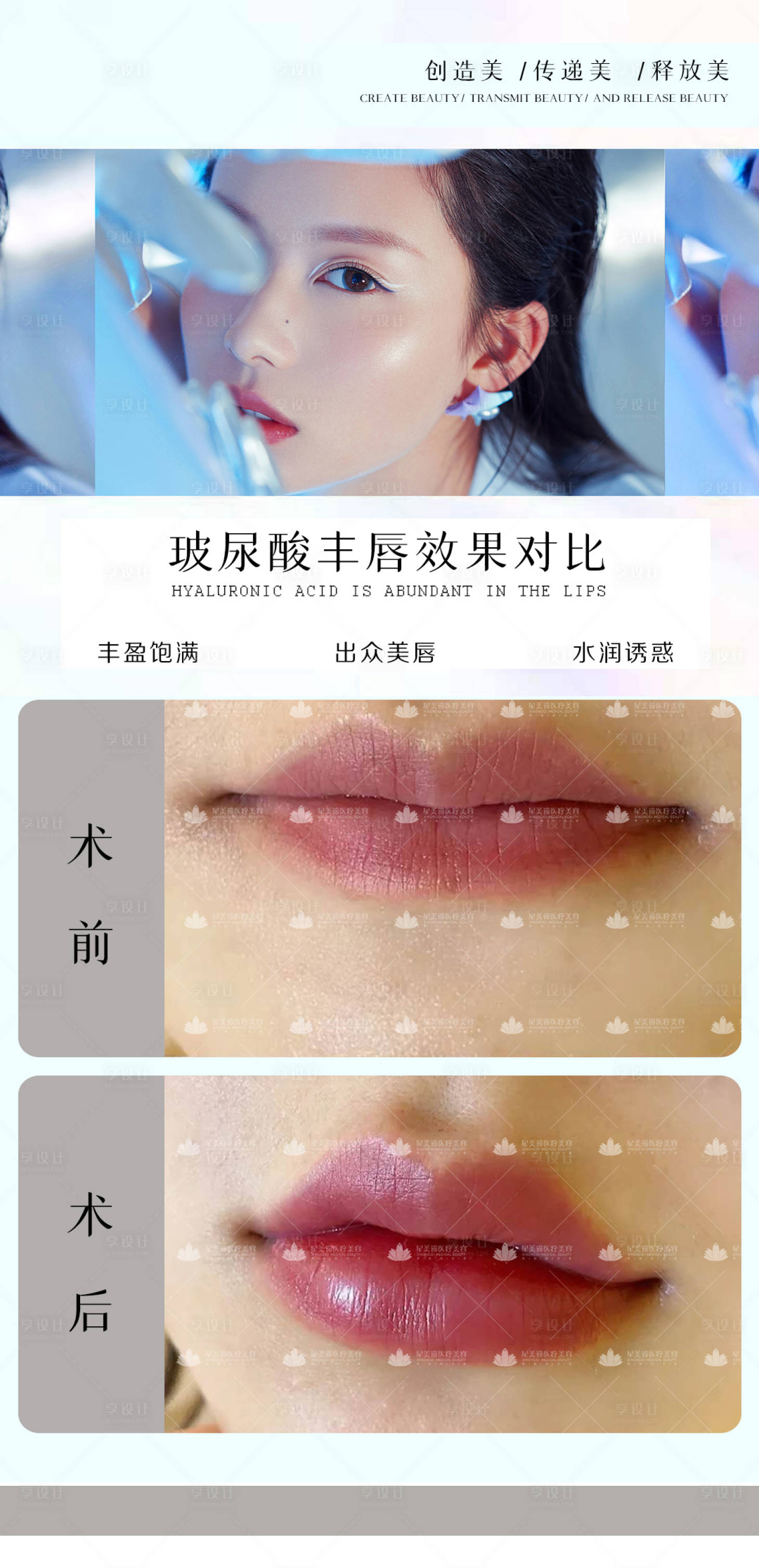 源文件下載【醫美玻尿酸豐唇對比海報】編號：19860005156635669