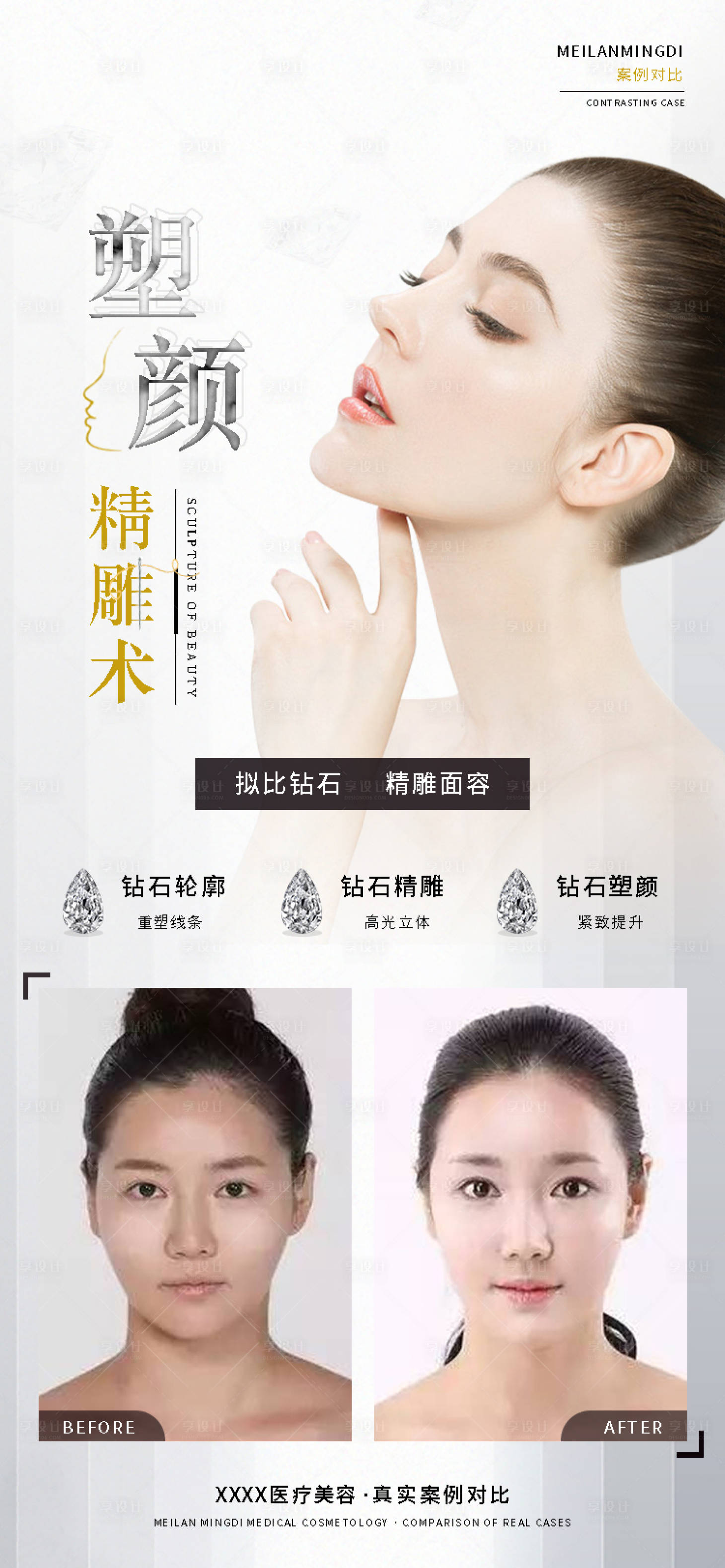 源文件下载【医美案例对比图海报 】编号：41380005015384020