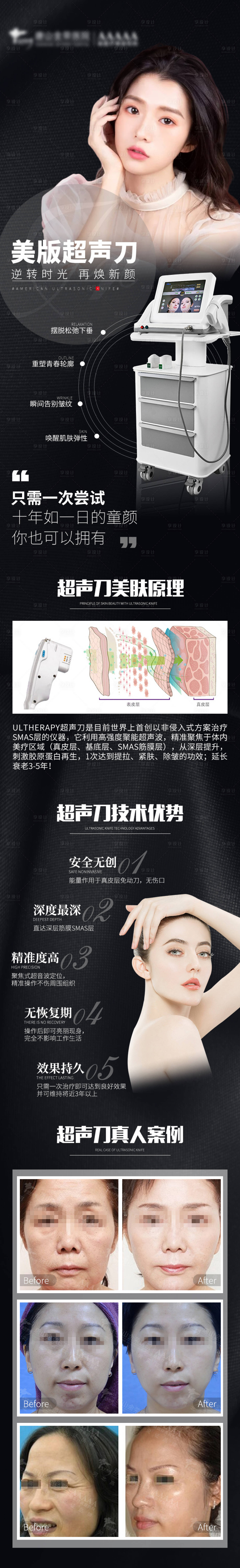源文件下载【医美美版超声刀专题】编号：55240005326003633