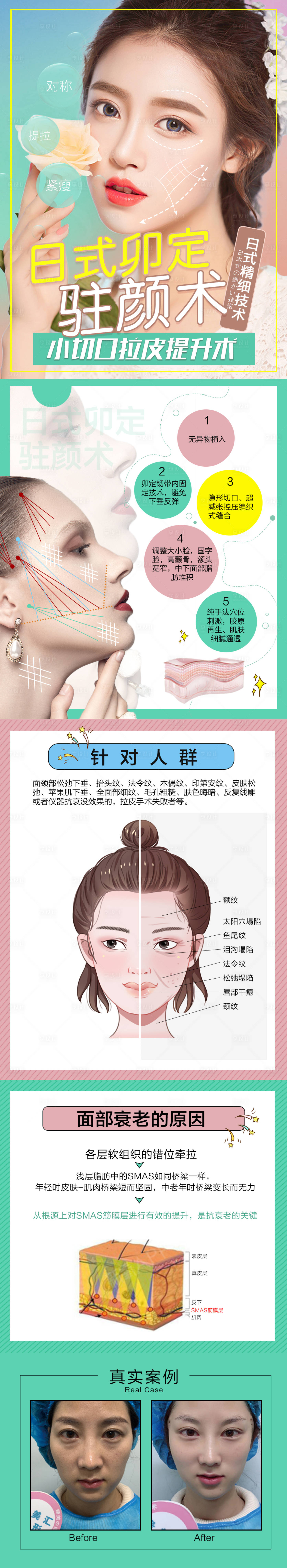 源文件下载【享设计】搜索编号：36970005162279507【线雕医美详情页】