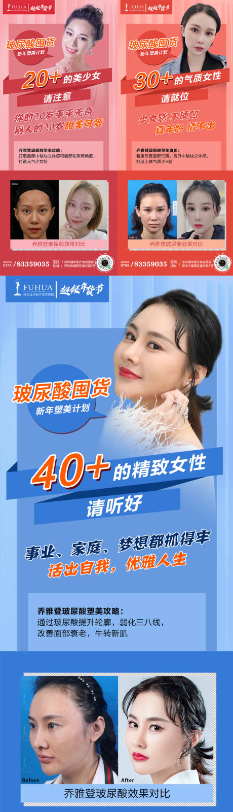 源文件下载【医美玻尿酸囤货乔雅登案例对比海报】编号：18690005774301308