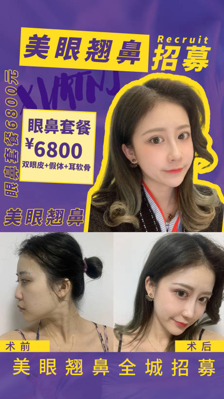 源文件下载【医美鼻综合案例海报】编号：63310005683716876