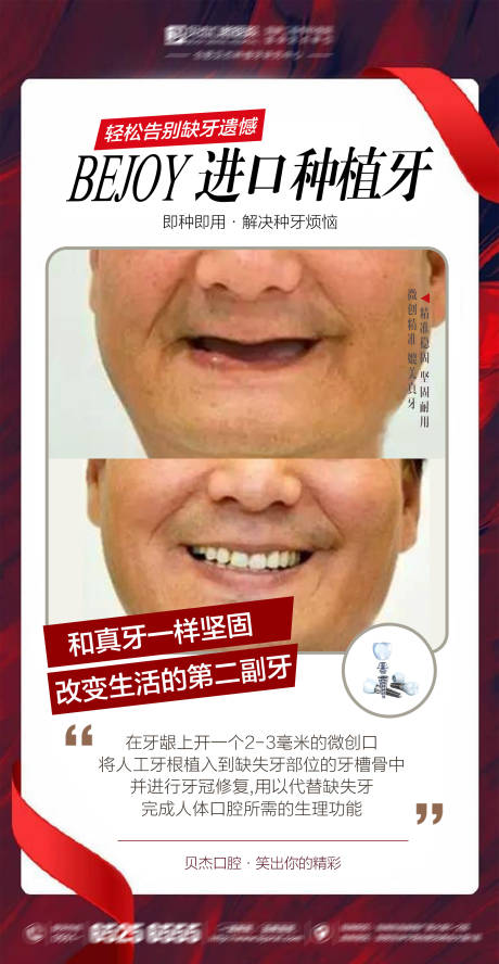 源文件下载【享设计】搜索编号：98250005832096659【口腔种植牙案例海报】