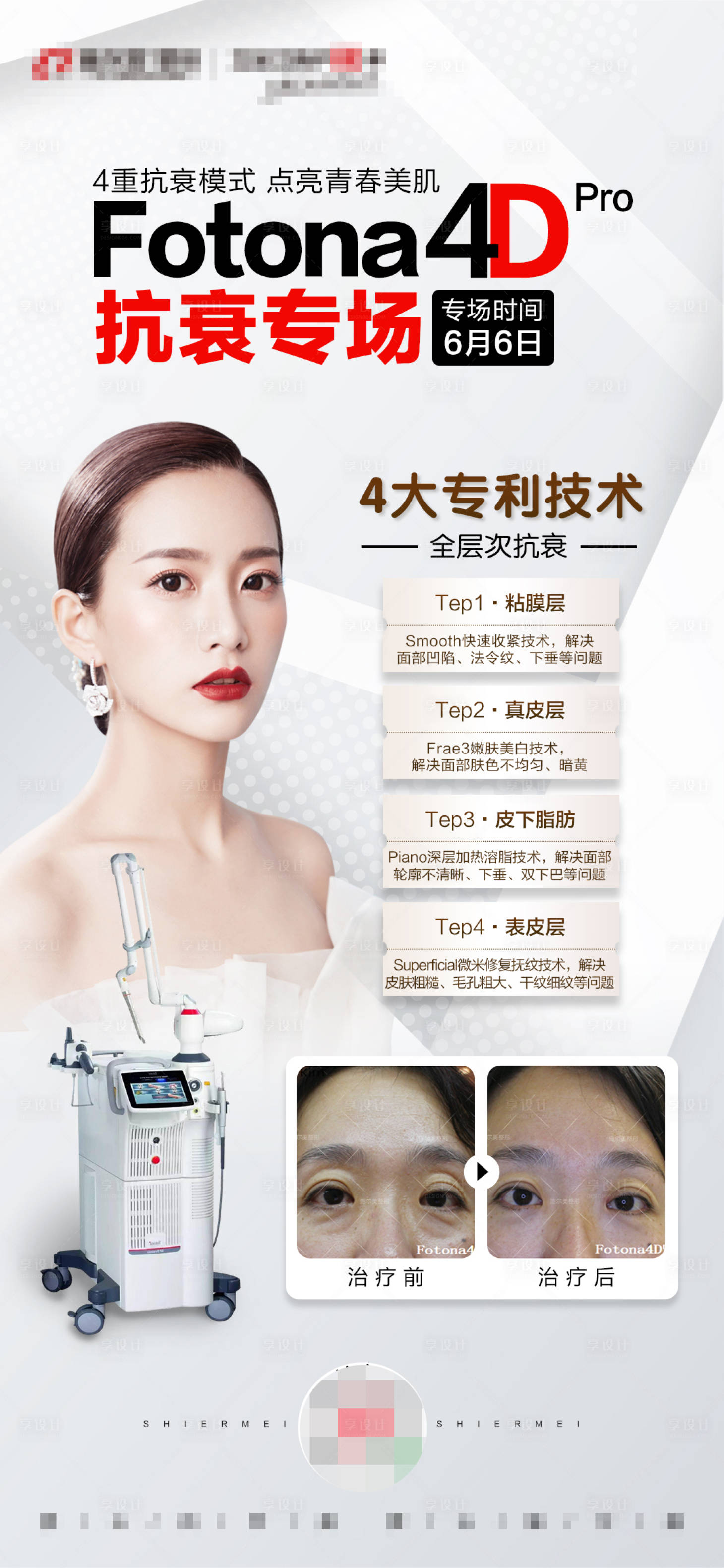 源文件下载【享设计】搜索编号：17320005760279189【FOTONA 4D 朋友圈海报】